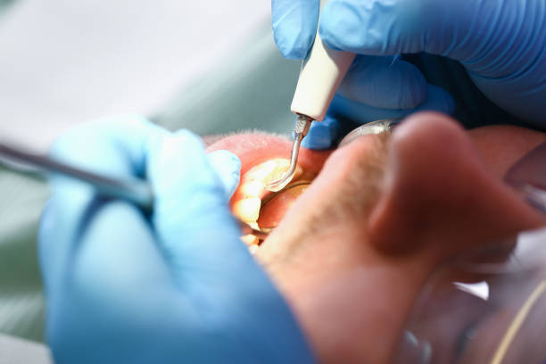 Best After-Hours Emergency Dentist in Charlotte Harbor, FL